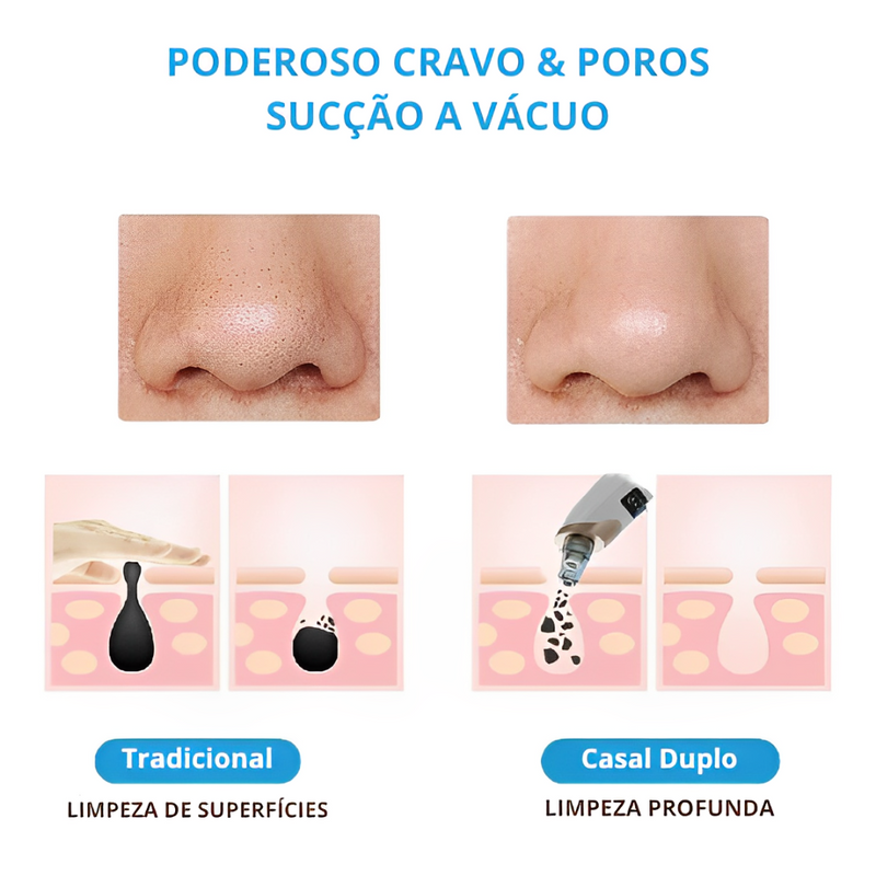 Removedor Elétrico de Cravo Facial - EzyShop